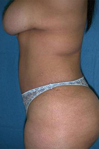 09 1 After