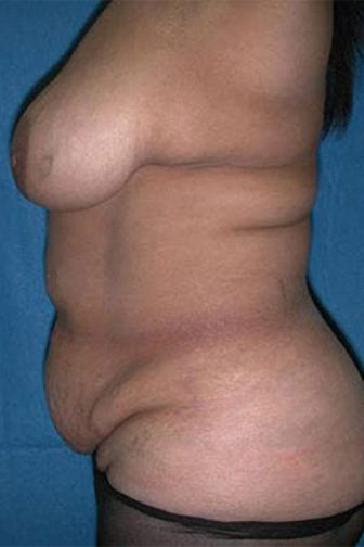 09 1 Before