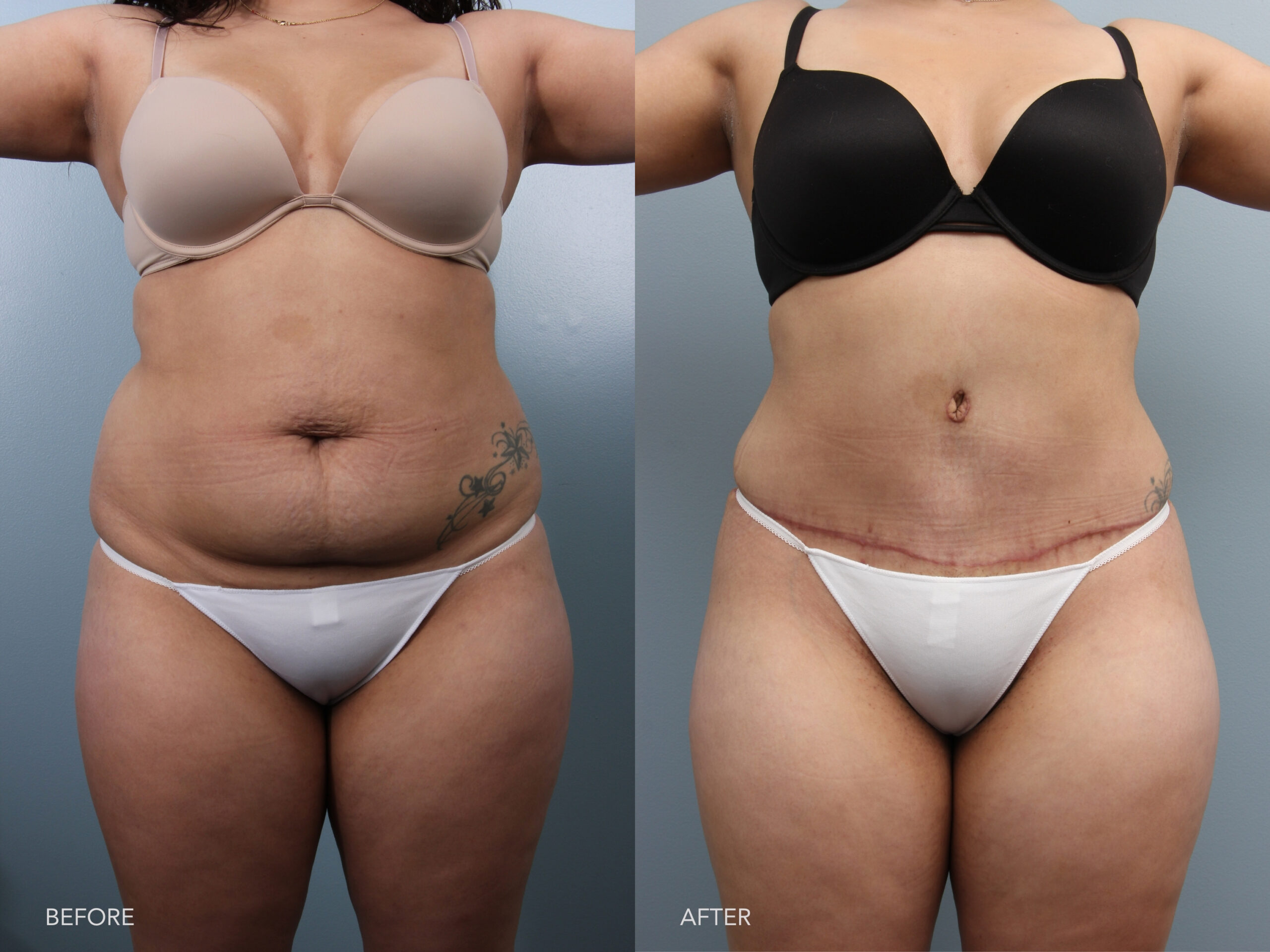 Average Female Stomach